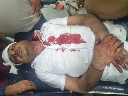 गजनेर रोड पर कार सवार पर हमले की आई वजह सामने,नौ के खिलाफ मामला दर्ज